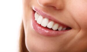 Teeth Whitening - Nelson Ridge Family Dental