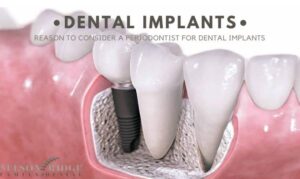 Periodontist For Dental Implants