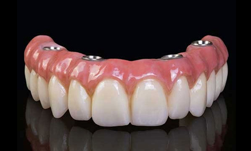 Dental prosthetic upper denture with artificial teeth and pink gum-colored base displayed against black background.
