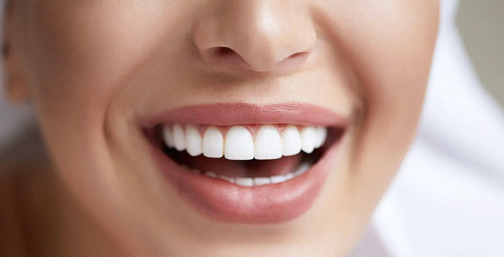 Close-up of person's bright, healthy smile showing white teeth and natural complexion.
