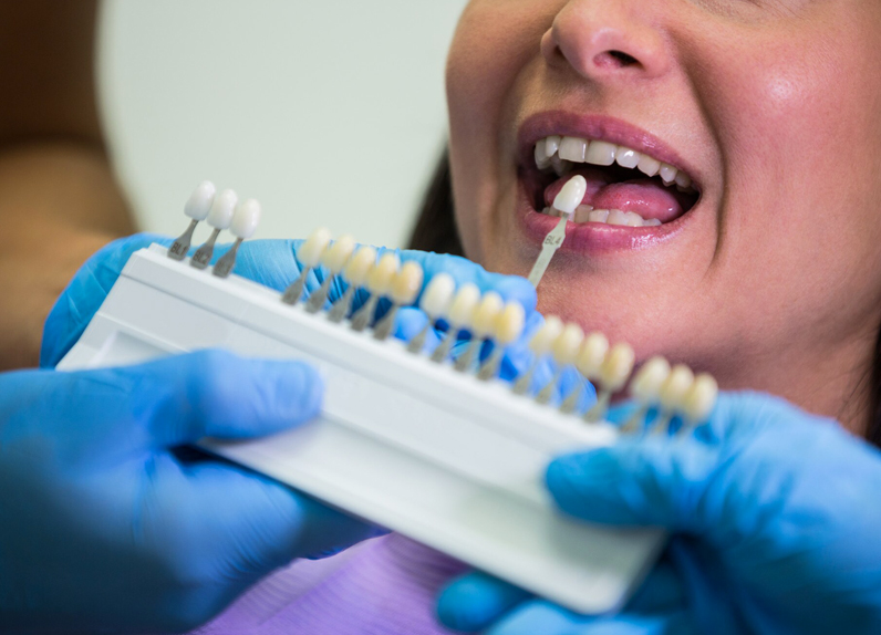 Person receiving dental shade guide comparison during tooth color matching at dental office.